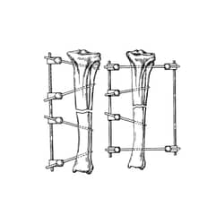 Med Vet International&nbsp;Small Fixation Type II Kit, Small IM Pin, 3/32” x 8” Rod, 6”L, J0371KBS, 1 Kit
