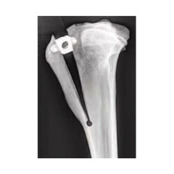 Med Vet International&nbsp;2.4mm Titanium Screw for 10.5mm x 22mm TTA Cage, J1072RBT