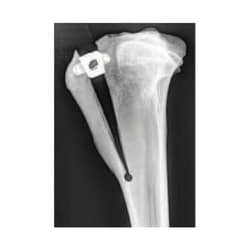 Med Vet International&nbsp;Titanium TTA Cage, 3mm x 10mm, 2.4mm Screw, J1072GAT