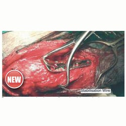 Med Vet International&nbsp;TPLO Wire Guide and Reduction Forcep, Right, 215mm, J1272