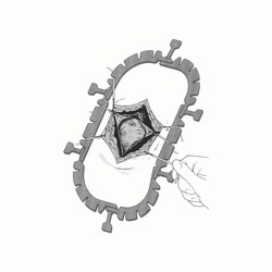 Med Vet International&nbsp;The Lone Star Veterinary Retractor System, Ring Retractor Only, Large, J4405