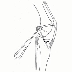 Med Vet International&nbsp;Graft Passer with Small Eye, J0236SE