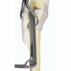 Med Vet International&nbsp;Saw Guide for TTO, J0436G