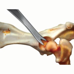 Med Vet International&nbsp;Femoral Disarticulator, Large, 7.75