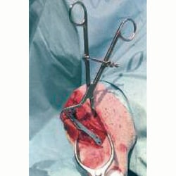 Med Vet International&nbsp;TTA Spin Lock Reduction Forceps, 7.5in, J0212KL, Each