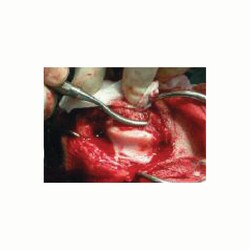 Med Vet International&nbsp;Osteophyte Rasp, J0209R, Each