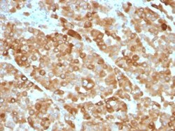 Biotium Tyrosinase(OCA1/812), CF740 conjugate, 0.1mg/mL, Quantity: Each