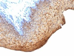 Biotium Cytokeratin 10/13(DE-K13), CF740 conjugate, 0.1mg/mL, Quantity: