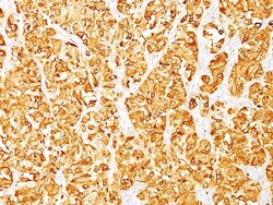 Biotium MART-1 / Melan-A / MLANA (Melanoma Marker)(DT101 + BC199), CF740
