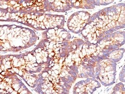 Biotium&nbsp;CD66 (CEA)(CEA31), CF740 conjugate, 0.1mg/mL