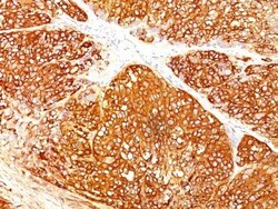 Biotium&nbsp;Melanoma Marker(HMB45 + A103 + T311), CF740 conjugate, 0.1mg/mL