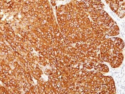 Biotium&nbsp;Melanoma Marker(HMB45 + M2-7C10 + M2-9E3 + T311), CF740 conjugate, 0.1mg/mL