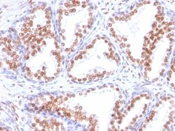 Biotium&nbsp;Androgen Receptor(DHTR/882), CF740 conjugate, 0.1mg/mL
