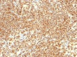 Biotium&nbsp;CD20(IGEL/773), CF740 conjugate, 0.1mg/mL
