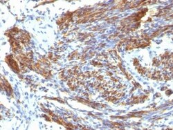 Biotium&nbsp;Caldesmon, HMW (h-Caldesmon)(CALD1/820), CF740 conjugate, 0.1mg/mL