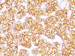 Biotium&nbsp;Renal Cell Carcinoma (Carbonic Anhydrase IX)(PN-15), CF740 conjugate, 0.1mg/mL