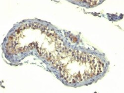 Biotium&nbsp;TGFalpha(TG86), CF740 conjugate, 0.1mg/mL