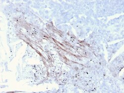 Biotium&nbsp;Tenascin C (Stromal Marker for Epithelial Malignancy)(TNC/3635), CF488A conjugate, 0.1mg/mL