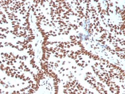 Biotium&nbsp;Estrogen Receptor, alpha (Marker of Estrogen Dependence)(ESR1/3556), CF640R conjugate, 0.1mg/mL