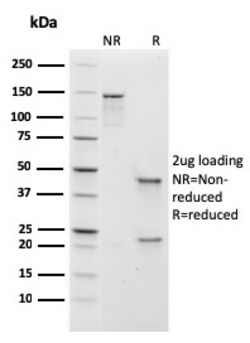 Biotium&nbsp;Human IgM (Immunoglobulin Mu Heavy Chain) (B-Cell Marker)(rIGHM/1623), CF640R conjugate, 0.1mg/mL