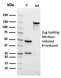 Biotium&nbsp;Spectrin beta III (SPTBN2)(rSPTBN2/1778), CF647 conjugate, 0.1mg/mL