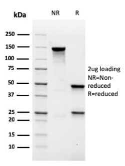 Biotium&nbsp;MALT1 (MALT-Lymphoma Marker)(rMT1/410), CF405S conjugate, 0.1mg/mL