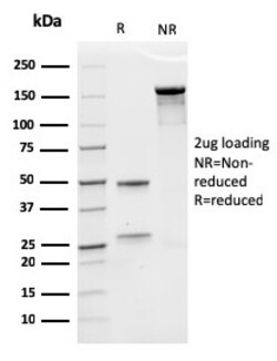 Biotium&nbsp;Erythropoietin (EPO) (Marker of Placentation Disorders)(rEPO/1367), CF647 conjugate, 0.1mg/mL