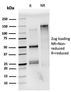 Biotium&nbsp;Estrogen Receptor, alpha (Marker of Estrogen Dependence)(ESR1/3559), 0.2mg/mL