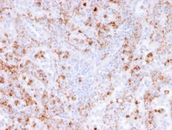 Biotium&nbsp;Calprotectin / MRP14 / S100A9 / Calgranulin B(rMAC3781), CF640R conjugate, 0.1mg/mL