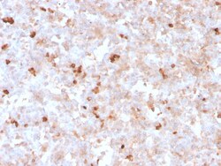 Biotium&nbsp;Lambda Light Chain (B-Cell Marker)(rLLC/1738), CF640R conjugate, 0.1mg/mL