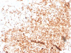 Biotium&nbsp;Human IgM (Immunoglobulin Mu Heavy Chain) (B-Cell Marker)(rIGHM/3802), CF640R conjugate, 0.1mg/mL