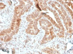 Biotium&nbsp;AKT1 (Prognostic Marker for Neuroendocrine Tumors)(rAKT1/2491), CF640R conjugate, 0.1mg/mL