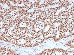 Biotium&nbsp;Estrogen Receptor, alpha (Marker of Estrogen Dependence)(ESR1/3557), 0.2mg/mL