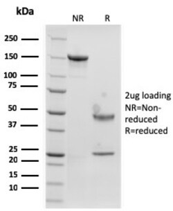 Biotium&nbsp;Langerin / CD207 (Marker of Langerhans Cells)(rLGRN/1821), CF594 conjugate, 0.1mg/mL
