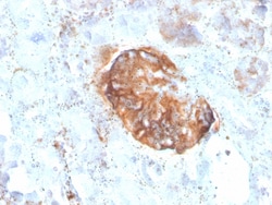 Biotium&nbsp;MTAP (Tumor Suppressor Marker)(rMTAP/1813), CF594 conjugate, 0.1mg/mL
