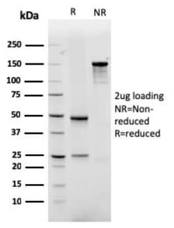 Biotium&nbsp;GLUT-1 (Tumor Progression and Mesothelioma Marker)(rGLUT1/2476), CF594 conjugate, 0.1mg/mL