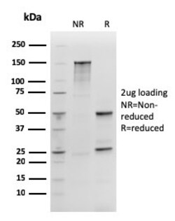 Biotium&nbsp;SOX2 (Embryonic Stem Cell Marker)(rSOX2/1792), CF594 conjugate, 0.1mg/mL