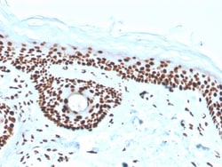 Biotium&nbsp;Nucleophosmin (Acute Myeloid Leukemia Marker)(rNPM1/1901), CF594 conjugate, 0.1mg/mL