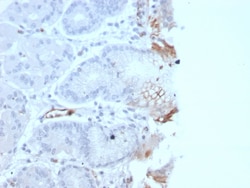 Biotium&nbsp;von Willebrand Factor / Factor VIII Related-Ag (Endothelial Marker)(rVWF/2480), CF647 conjugate, 0.1mg/mL
