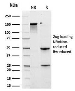 Biotium&nbsp;Cytokeratin 6A (KRT6A) (Basal Cell Marker)(rKRT6A/2100), 0.2mg/mL