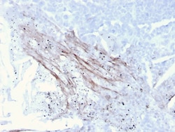 Biotium&nbsp;Tenascin C (Stromal Marker for Epithelial Malignancy)(TNC/3635), 0.2mg/mL