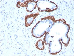 Biotium&nbsp;Cytokeratin 5 (KRT5) (Basal, Myoepithelial & Mesothelial Cell Marker)(KRT5/3594), CF594 conjugate, 0.1mg/mL