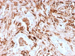 Biotium&nbsp;Ferritin, Light Chain (Node-Negative Breast Tumor Prognostic Marker)(rFTL/1388), 0.2mg/mL