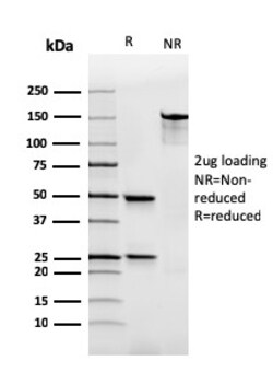 Biotium&nbsp;Human Immunoglobulin Alpha (IgA) Heavy Chain(rHISA43), Biotin conjugate, 0.1mg/mL