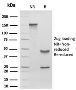 Biotium&nbsp;Retinol Binding Protein-1 (RBP1)(rRBP1/872), 0.2mg/mL