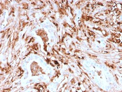 Biotium&nbsp;Ferritin, Light Chain (Node-Negative Breast Tumor Prognostic Marker)(rFTL/1388), 0.2mg/mL