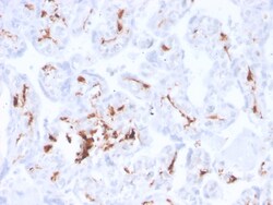 Biotium&nbsp;Factor XIIIa (Coagulation Factor XIIIA Chain)(F13A1/3772R), 0.2mg/mL
