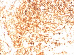 Biotium&nbsp;Human IgM (Immunoglobulin Mu Heavy Chain) (B-Cell Marker)(IGHM/3803R), CF640R conjugate, 0.1mg/mL