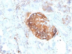 Biotium&nbsp;MTAP (Tumor Suppressor Marker)(rMTAP/1813), CF647 conjugate, 0.1mg/mL