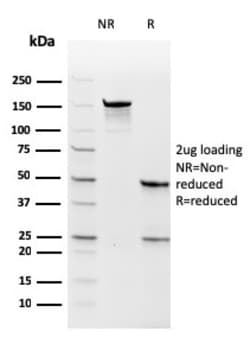 Biotium&nbsp;Thymidylate Synthase (5-FU Resistance Marker)(rTYMS/1884), CF640R conjugate, 0.1mg/mL
